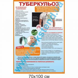 купити Стенд