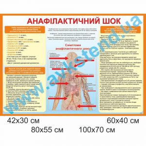 купити Стенд