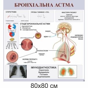 стенди купити, стенди замовити, стенди Україна, стенди для внз, стенди для вищої освіти, медичні стенди, медицина, стенди з медицини, астма, бронхіальна астма