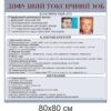 стенди купити, стенди замовити, стенди Україна, стенди для внз, стенди для вищої освіти, медичні стенди, медицина, стенди з медицини, дифузний токсичний зоб,