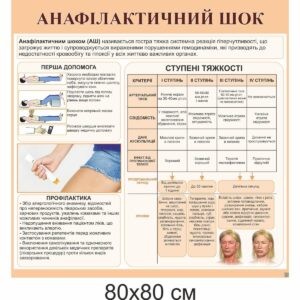 стенди купити, стенди замовити, стенди Україна, стенди для внз, стенди для вищої освіти, медичні стенди, медицина, стенди з медицини, анафілактичний шок